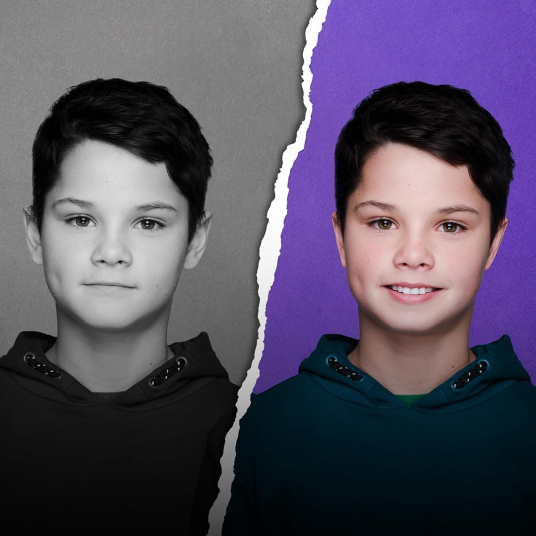 لاصق تصحيح الأذن المرن - 5