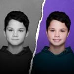 لاصق تصحيح الأذن المرن - 5