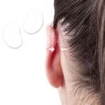 لاصق تصحيح الأذن المرن - 11