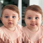 لاصق تصحيح الأذن المرن - 3