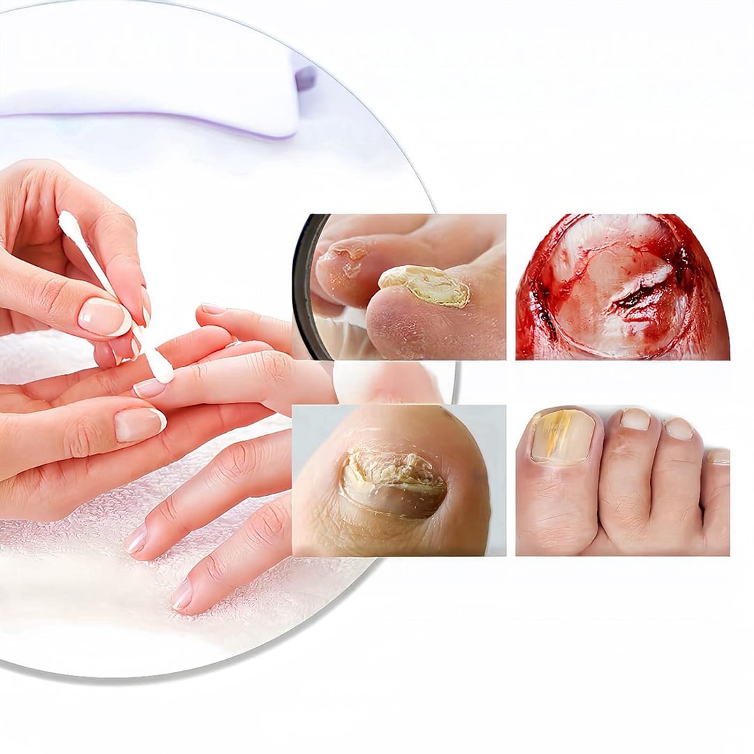 لاصقات علاج وإصلاح الأظافر - 10