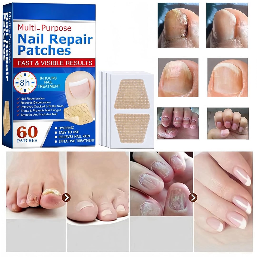 لاصقات علاج وإصلاح الأظافر - 9