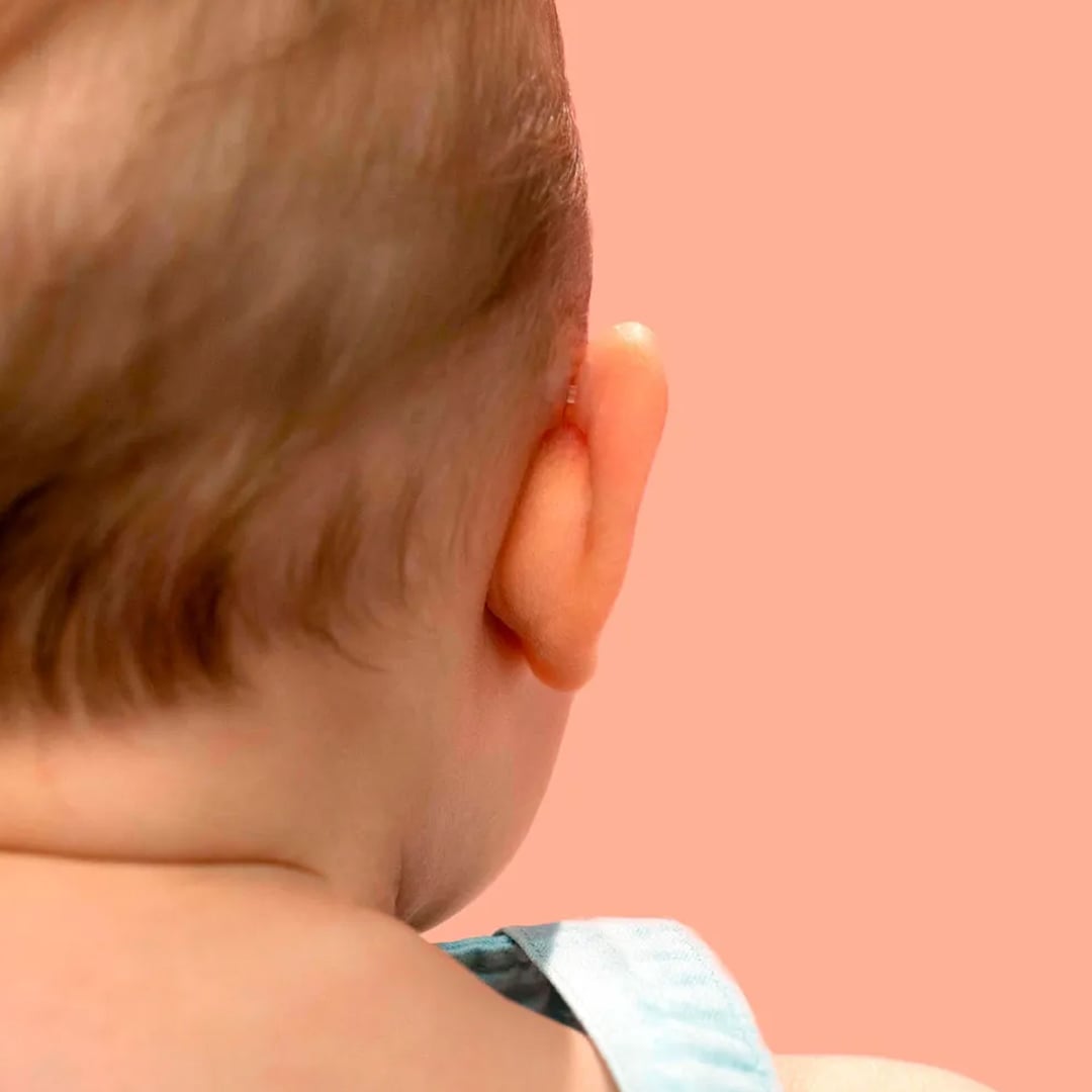 لاصق تصحيح الأذن المرن - 1