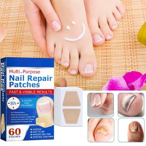 لاصقات علاج وإصلاح الأظافر