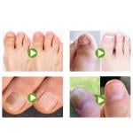 لاصقات علاج وإصلاح الأظافر - 8