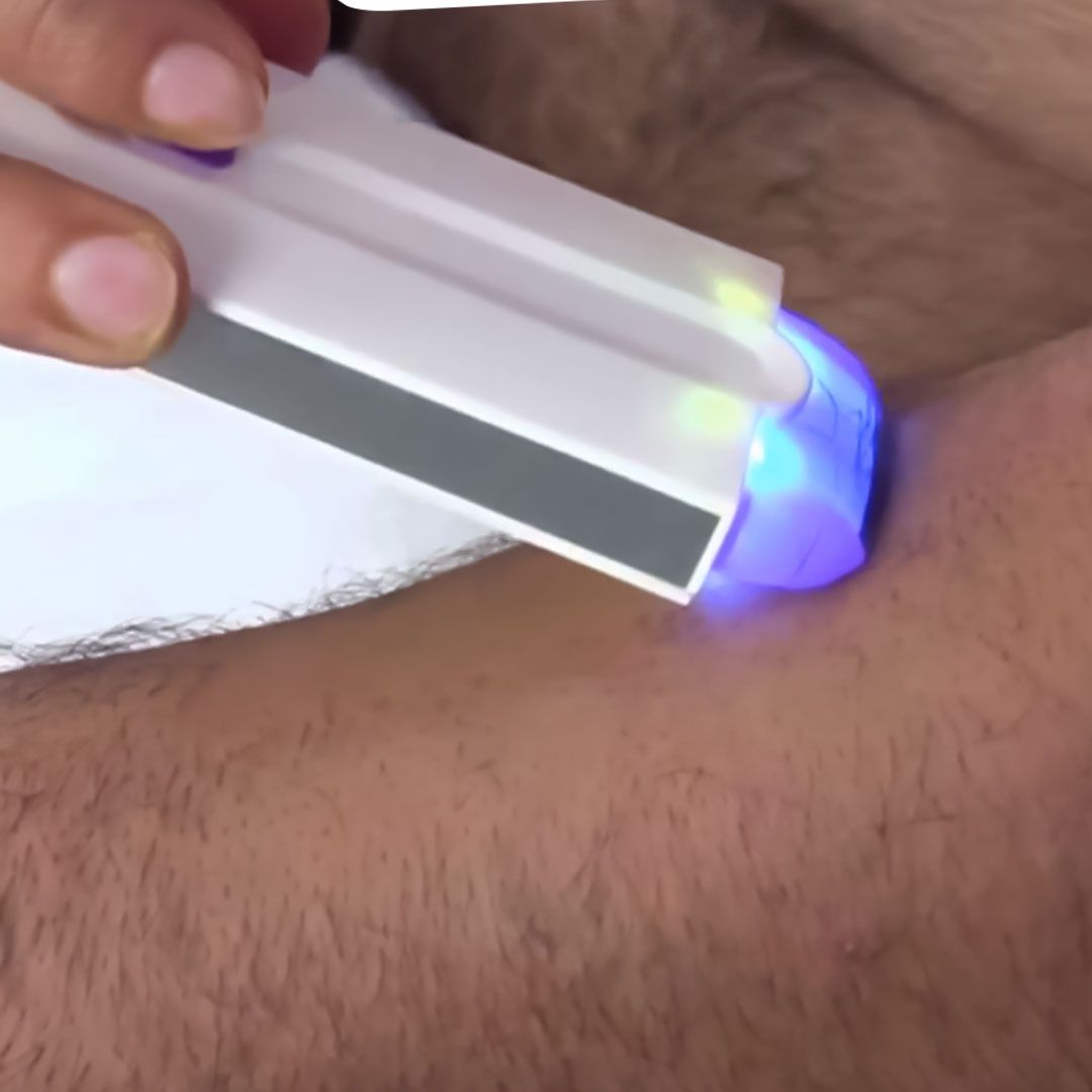 Finishing-Touch-Hair-Remover product thumbnail 10