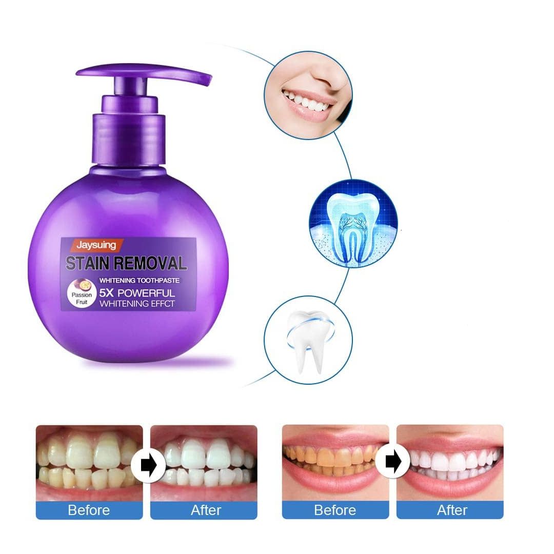 Stain Removal Whitening Toothpaste product thumbnail 5