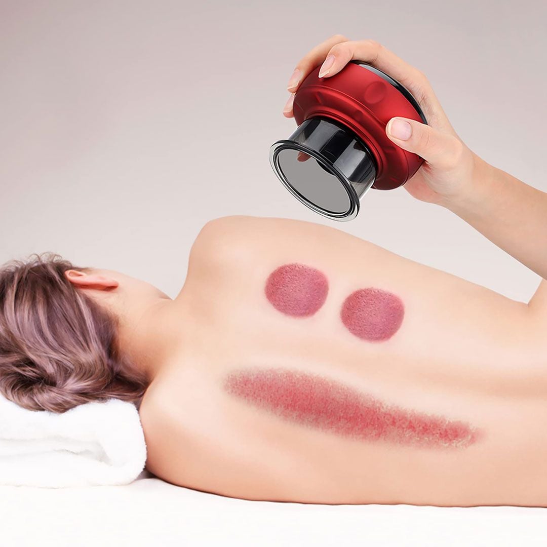 Wireless Cupping Device product thumbnail 3