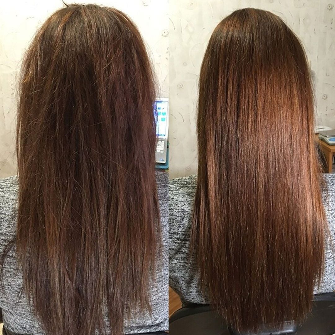 جهاز إزالة تقصف الشعر - 20