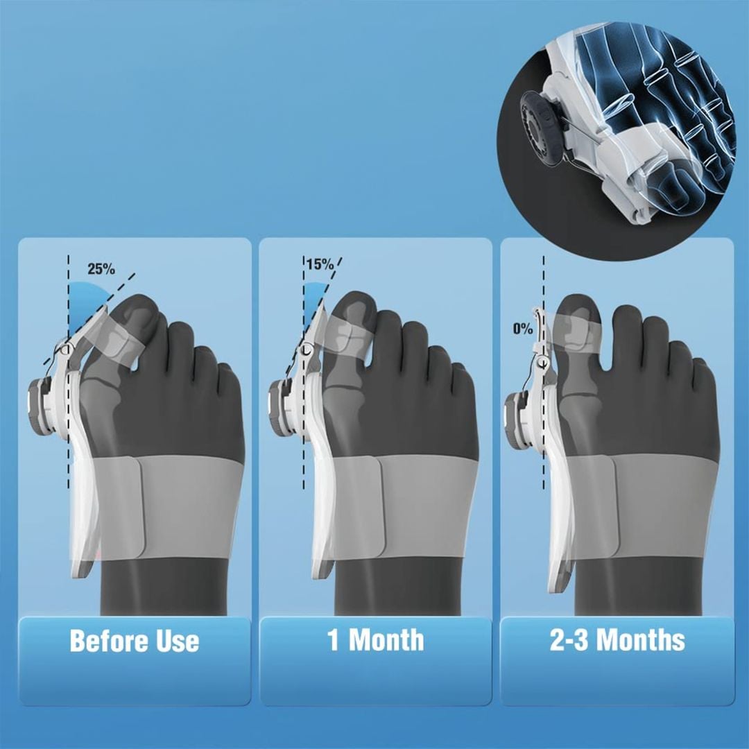 Adjustable Hallux Corrector Device product thumbnail 6