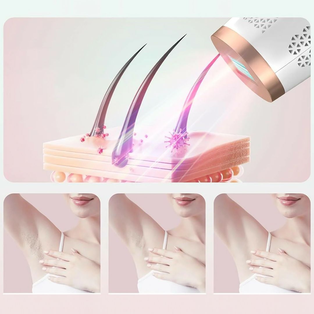 IPL Hair Removal product thumbnail 4