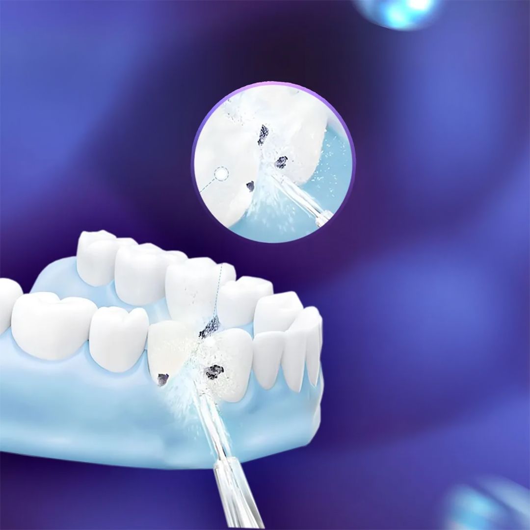 Portable Teeth Cleaning Device product thumbnail 4