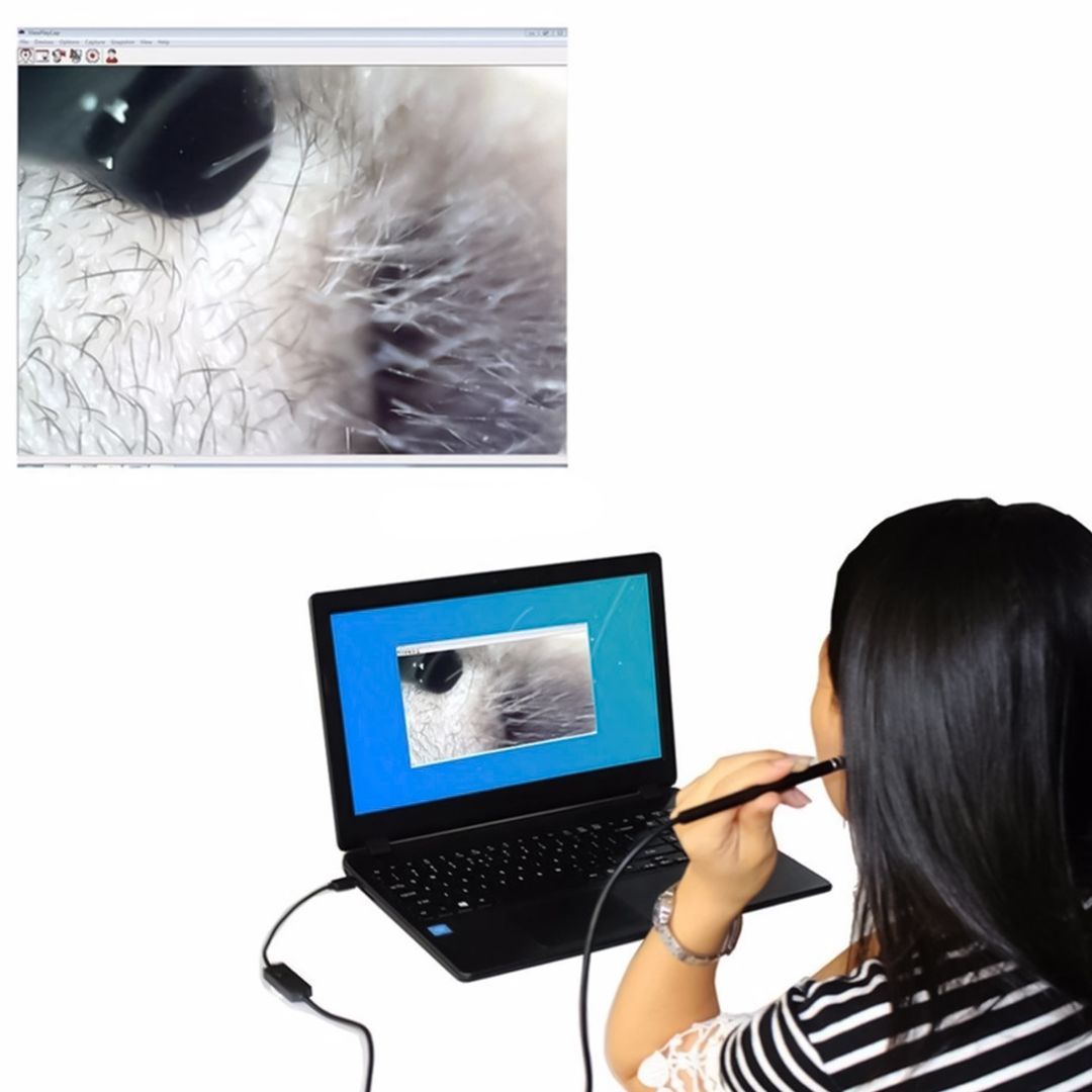 Visual Ear Cleaner product thumbnail 17