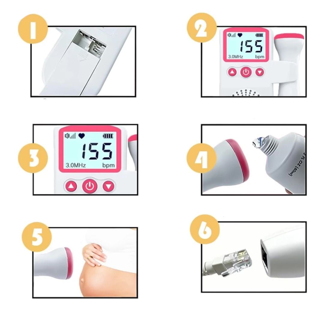 Fetal Heart Rate Monitor product thumbnail 9