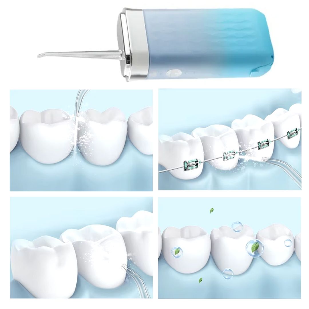 Portable Teeth Cleaning Device product thumbnail 6