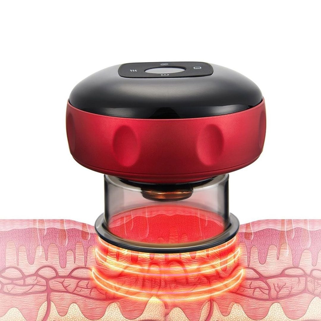 Wireless Cupping Device product thumbnail 4