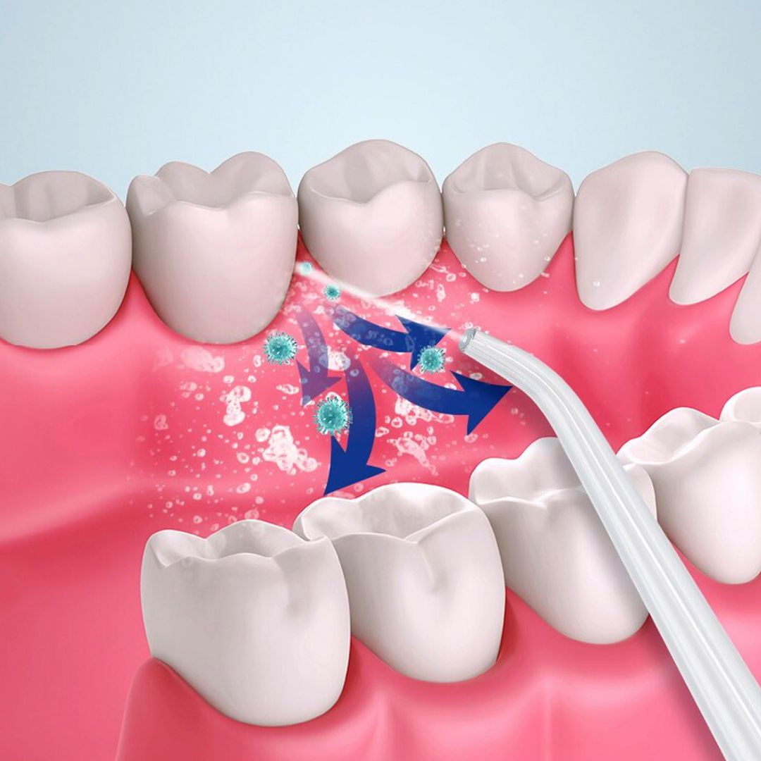 Portable Teeth Cleaning Device product thumbnail 8