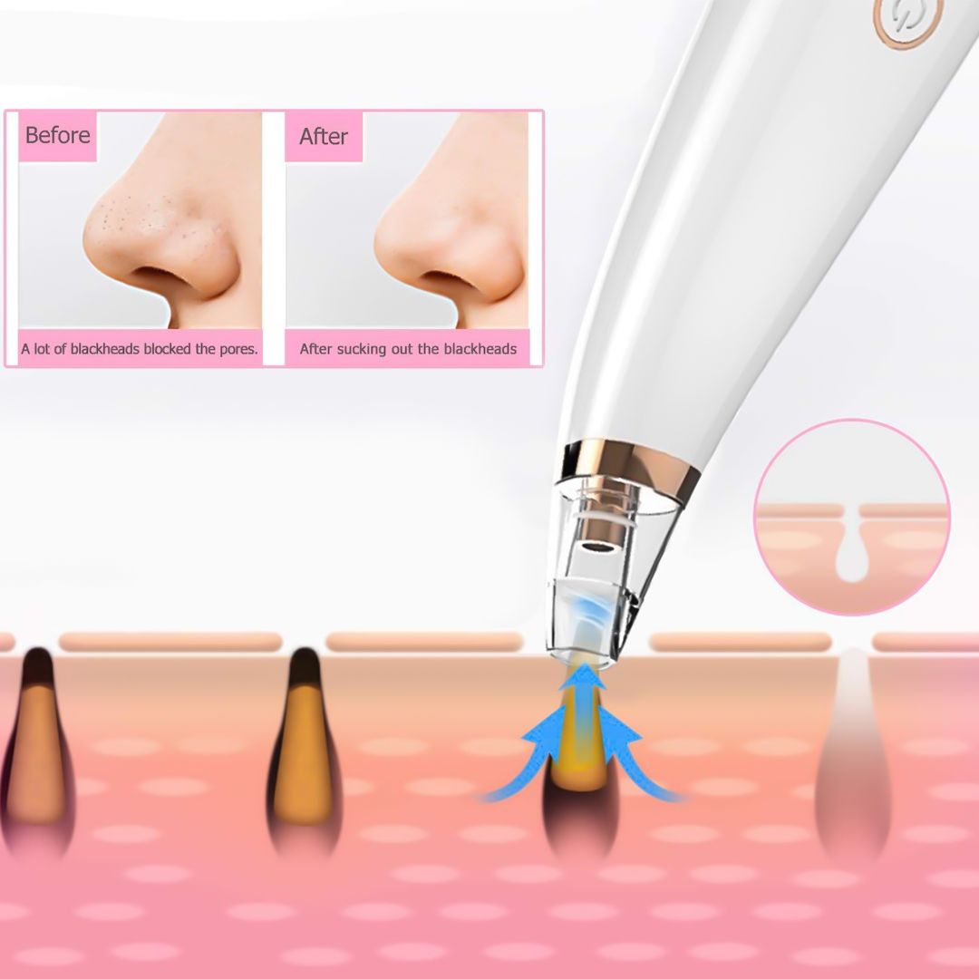 Pore Vacuum Blackhead Remover product thumbnail 9