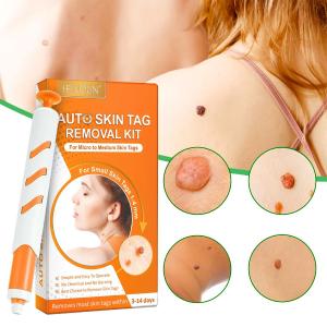 Skin Tag Removal Kit - 1