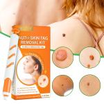 Skin Tag Removal Kit