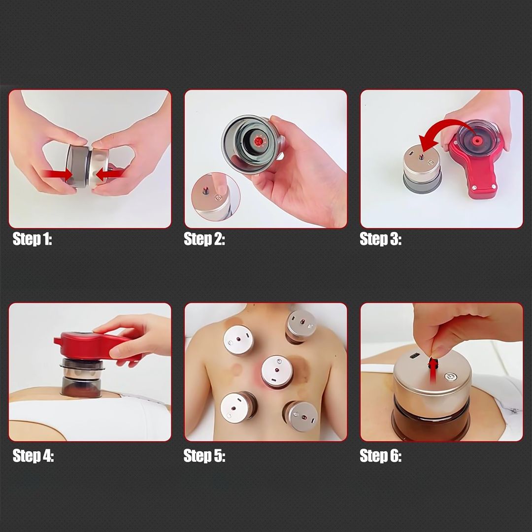 جهاز حجامة بالحرارة والشفط - 14