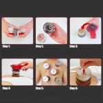 جهاز حجامة بالحرارة والشفط - 14