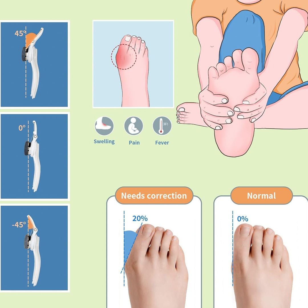 Adjustable Hallux Corrector Device product thumbnail 5