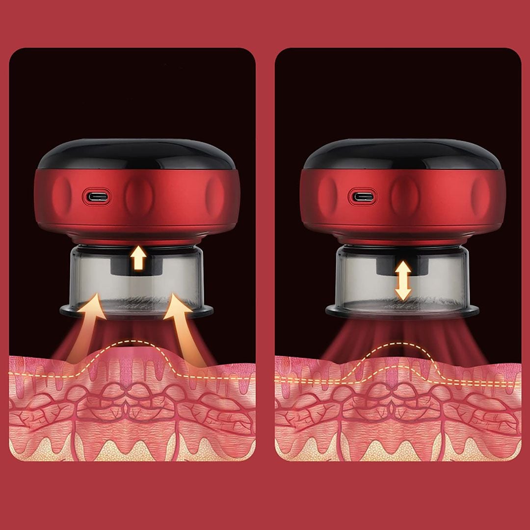 Wireless Cupping Device product thumbnail 9