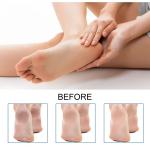 أداة ازالة الجلد الميت القابلة للشحن - 7