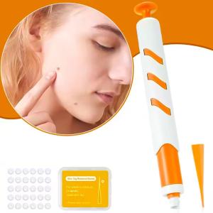 Skin Tag Removal Kit - 4