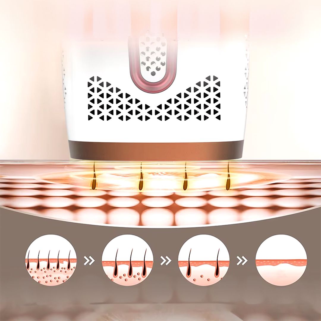 IPL Hair Removal product thumbnail 7